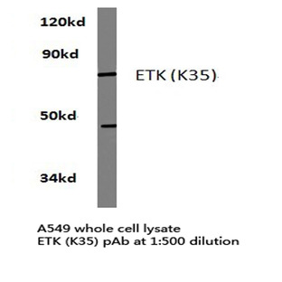 ETK (K35) pAb