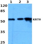 Cytokeratin 8 (G427) pAb