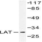 LAT (L185) pAb