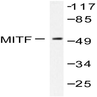 MITF (G174) pAb