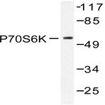 p70 S6K (D223) pAb