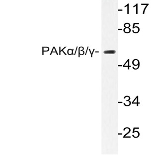 PAK1/2/3 (E417) pAb