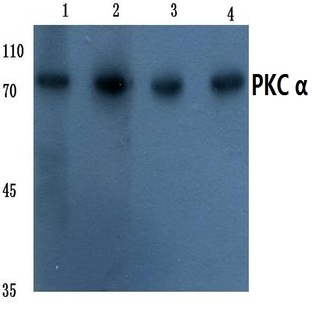 PKC (alpha) (G633) pAb