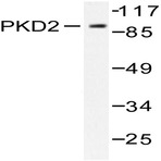 PKD2 (A872) pAb