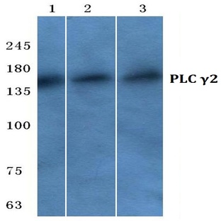 PLC (gamma)2 (N1211) pAb