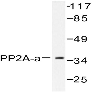 PP2A-(alpha) (T301) pAb