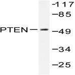 PTEN (Y379) pAb