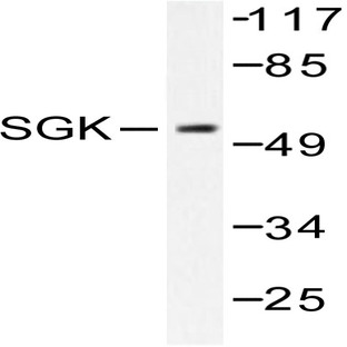 SGK 1 (P73) pAb