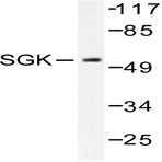 SGK 1 (P73) pAb