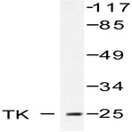 TK (P7) pAb