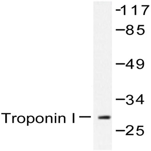 Troponin I3 (K39) pAb