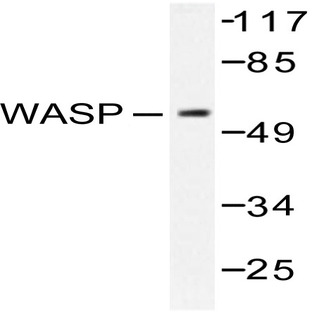 WASP (E284) pAb