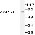 ZAP70 (T286) pAb