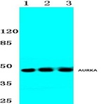 AURKA (P282) pAb