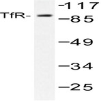 TfR1 (Y20) pAb