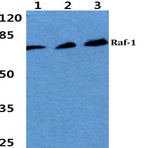 Bs1623_wb