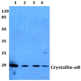 Crystallin-(alpha)B (F15) pAb