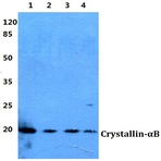 Crystallin-(alpha)B (F15) pAb