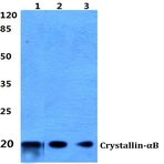 Crystallin-(alpha)B (L55) pAb