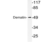 Dematin (E397) pAb