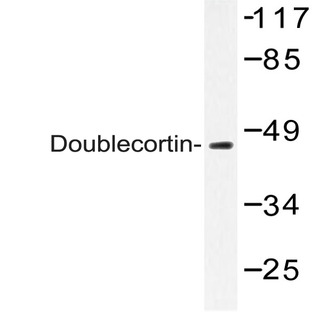 Doublecortin (K292) pAb