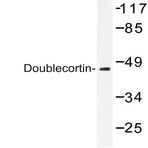 Doublecortin (K292) pAb