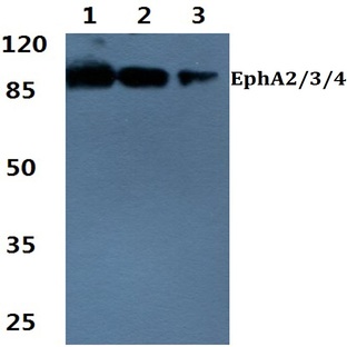 EphA2/3/4 (T587) pAb