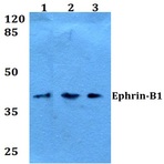 Ephrin-B1 (N312) pAb