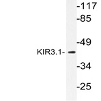 KIR3.1 (F181) pAb