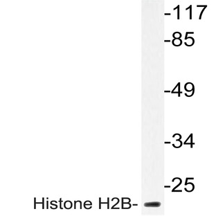 Histone H2B (K5) pAb