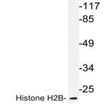 Histone H2B (K5) pAb