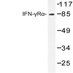 IFN-(gamma)R(alpha) (G456) pAb