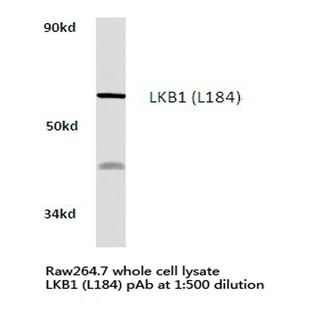 LKB1 (L184) pAb