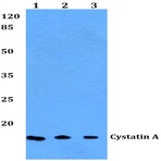 Cystatin A (G84) pAb