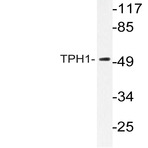 TPH1 (K54) pAb