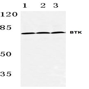 BTK (K216) pAb