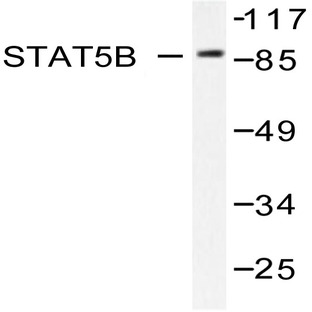 Stat5b (Y725) pAb