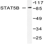 Stat5b (Y725) pAb