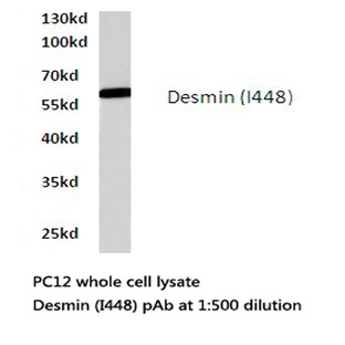 Desmin (I448) pAb