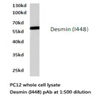 Desmin (I448) pAb