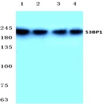 53BP1 (D2) pAb