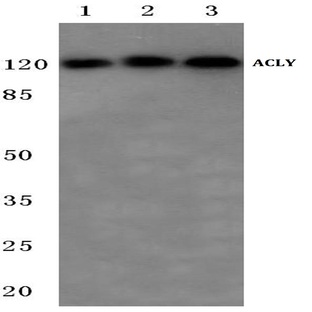  ATP-Citrate synthase (P449) pAb