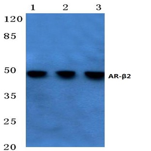 AR-(beta)2 (L342) pAb