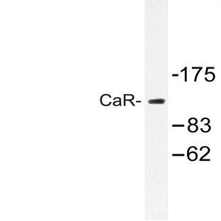 CaSR (A884) pAb