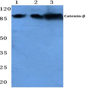 Catenin-(beta) (G650) pAb