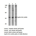 Cyclin D1 (L283) pAb