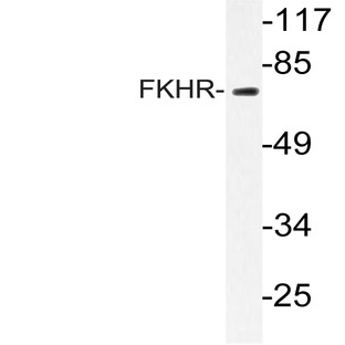 FKHR/FoxO1 (T323) pAb