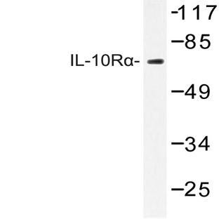 IL-10R(alpha) (L492) pAb