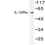 IL-10R(alpha) (L492) pAb