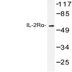 IL-2R(alpha) (R264) pAb